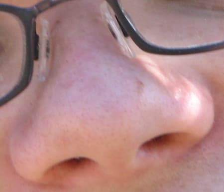 Odd Sensory Olfactory Assault Story