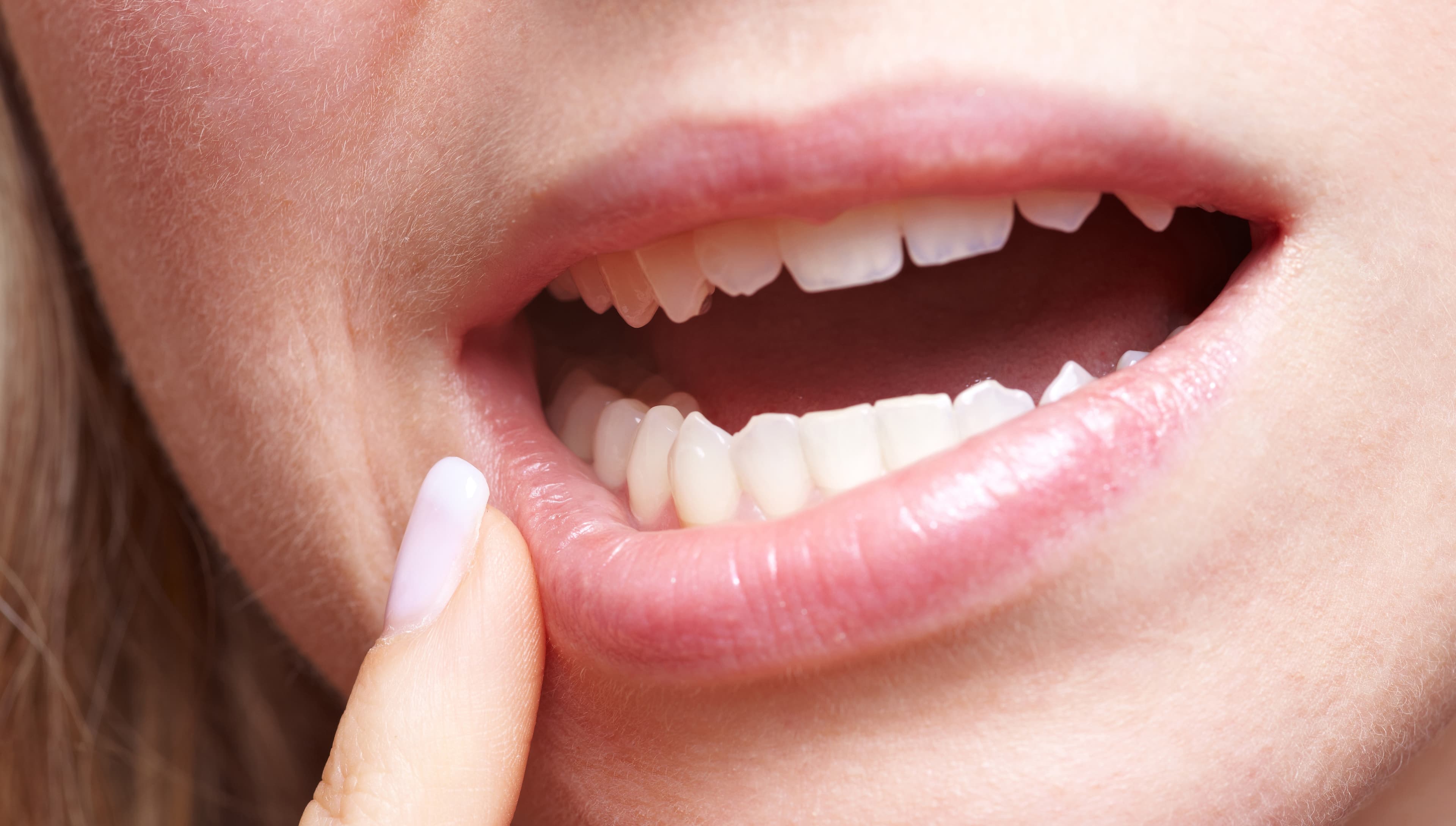 Show #311 - ASD patients and Dental Procedures
