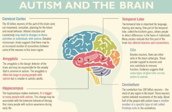 Why does it take brains to understand autism?