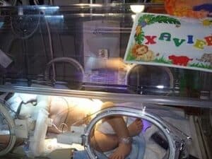 Autism and Jaundice: An Observation