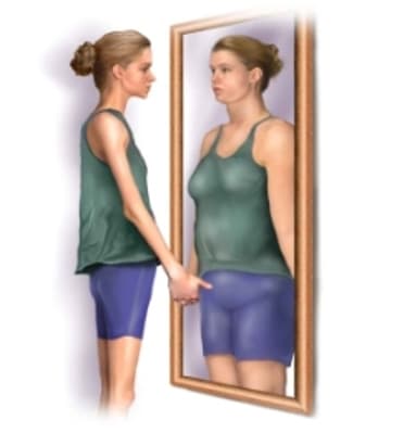 Is anorexia nervosa the “female form of Asperger’s?”