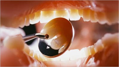 Question: Dentists and Autism